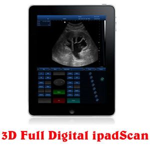 3D Full Digital Ipadscan Ultrasound Scanner PC Based Platform Convex Probe